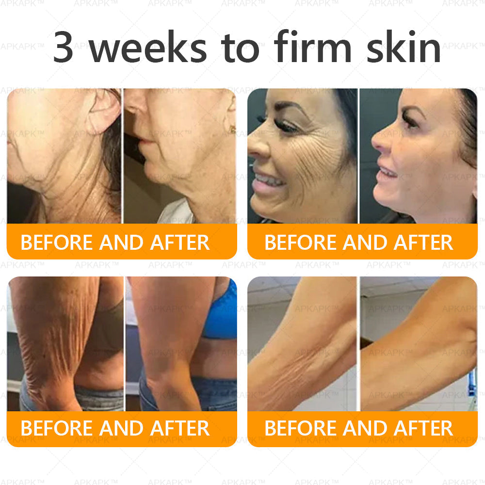 šāØ APKAPKĀ® Bee venom Comprehensive Cream š„ Sagging Skin, Fine Lines, Loss of Firmness, Flat Bust, Drooping Hips, and More