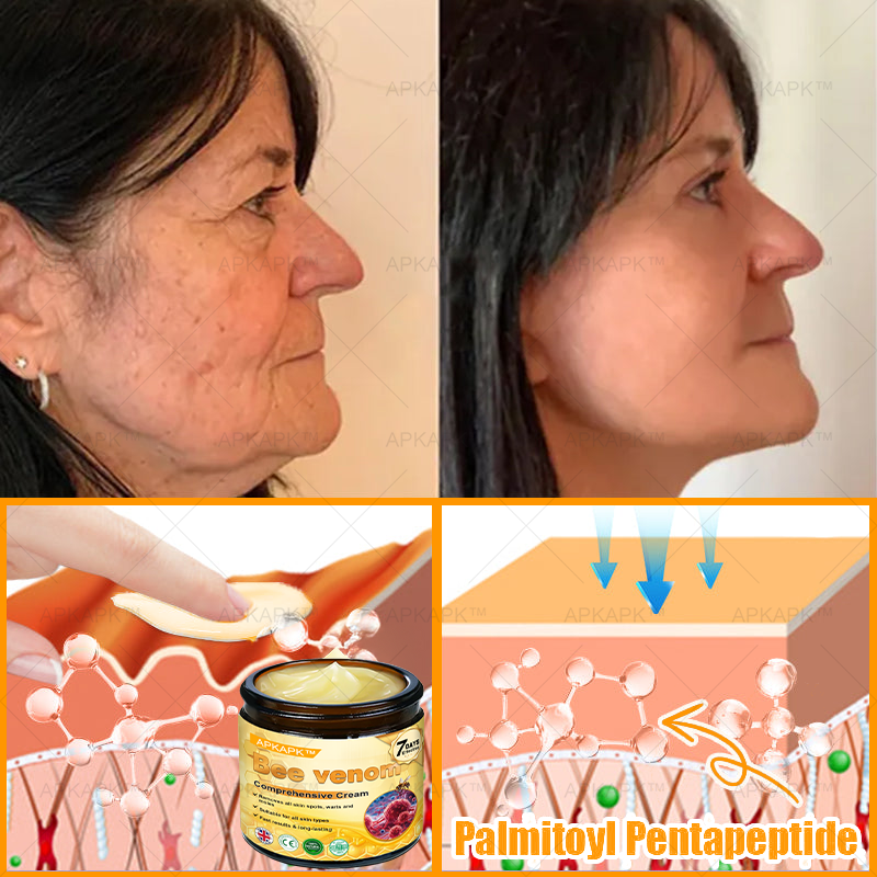 šāØ APKAPKĀ® Bee venom Comprehensive Cream š„ Sagging Skin, Fine Lines, Loss of Firmness, Flat Bust, Drooping Hips, and More