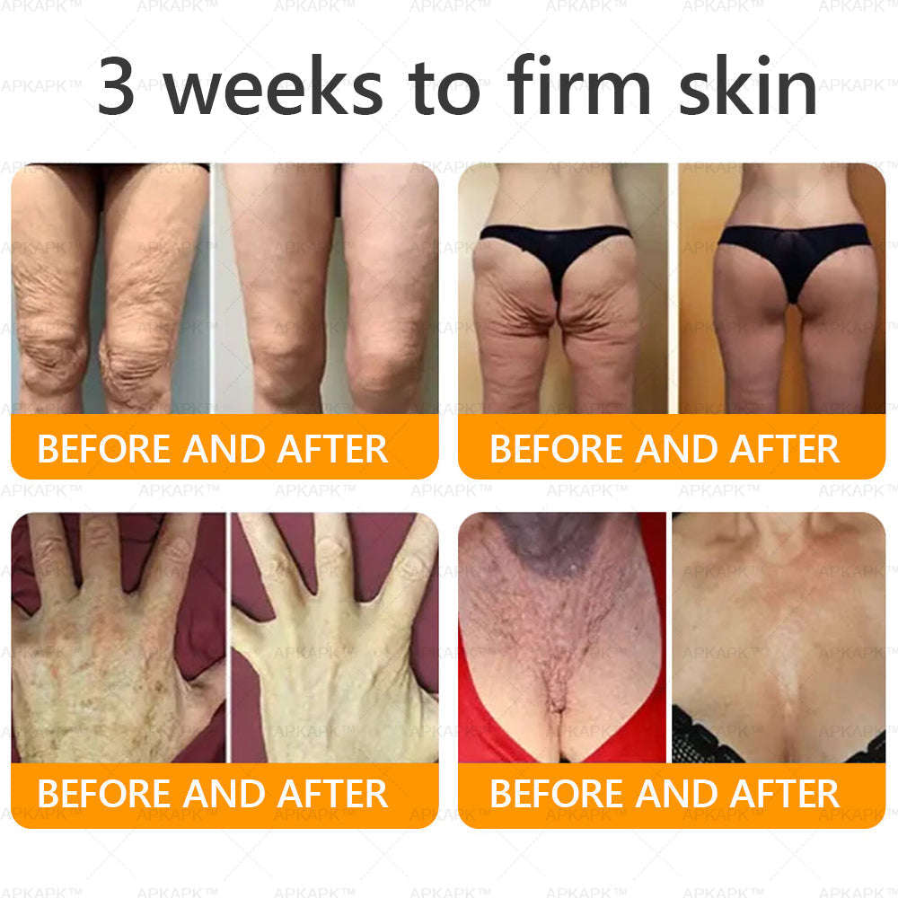 šāØ APKAPKĀ® Bee venom Comprehensive Cream š„ Sagging Skin, Fine Lines, Loss of Firmness, Flat Bust, Drooping Hips, and More