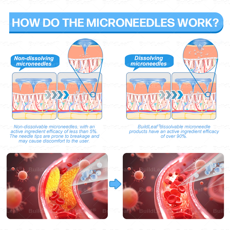 🚨 Hurry – 70% OFF Ends Soon! 🚨 Take control of your weight and health with 𝐵uil𝗱𝐿ea𝐟® GLP-1 Slim & Firm Nano Microneedle Patch. For obesity, metabolism, blood sugar and more — real results without painful injections.