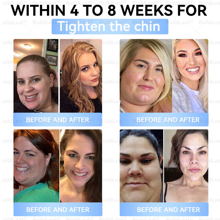 🚨 Hurry – 70% OFF Ends Soon! 🚨  Take control of your weight and health with 𝐵uil𝗱𝐿ea𝐟® GLP-1 Slim & Firm Nano Microneedle Patch. For obesity, metabolism, blood sugar and more — real results without painful injections.