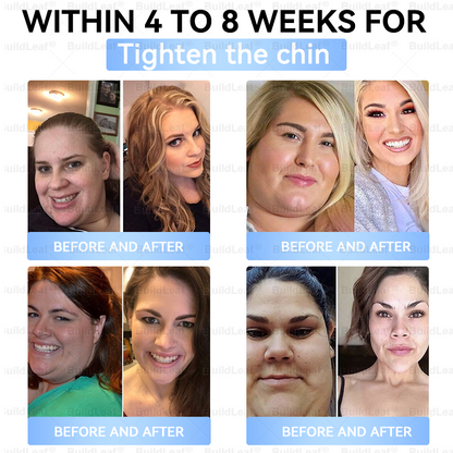 🚨 Hurry – 70% OFF Ends Soon! 🚨  Take control of your weight and health with 𝐵uil𝗱𝐿ea𝐟® GLP-1 Slim & Firm Nano Microneedle Patch. For obesity, metabolism, blood sugar and more — real results without painful injections.