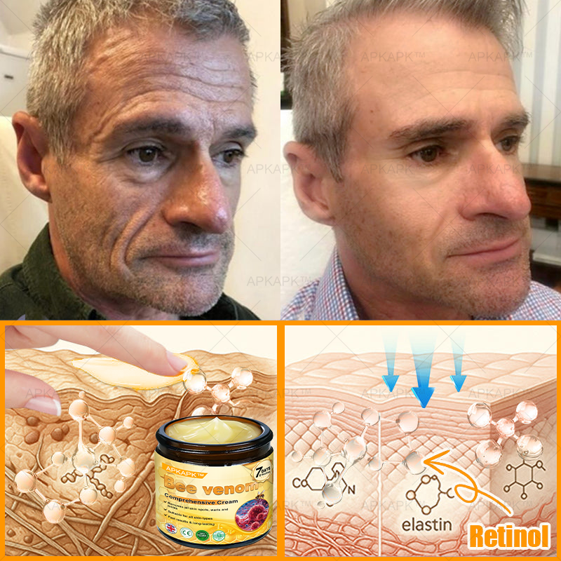 🎁 Surprise! You’ve unlocked 50% OFF APKAPK® Bee Venom Cream — only for the next 2 minutes! Don’t miss this exclusive upgrade!