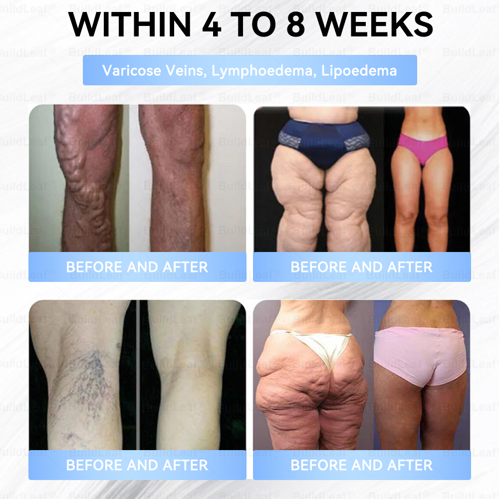 🚨 Hurry – 70% OFF Ends Soon! 🚨  Take control of your weight and health with 𝐵uil𝗱𝐿ea𝐟® GLP-1 Slim & Firm Nano Microneedle Patch. For obesity, metabolism, blood sugar and more — real results without painful injections.