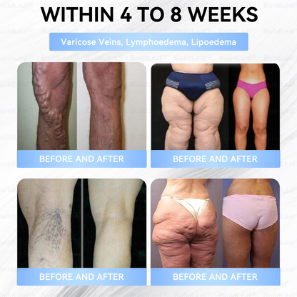 🚨 Hurry – 70% OFF Ends Soon! 🚨  Take control of your weight and health with 𝐵uil𝗱𝐿ea𝐟® GLP-1 Slim & Firm Nano Microneedle Patch. For obesity, metabolism, blood sugar and more — real results without painful injections.