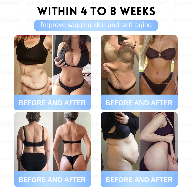 🚨 Hurry – 70% OFF Ends Soon! 🚨  Take control of your weight and health with 𝐵uil𝗱𝐿ea𝐟® GLP-1 Slim & Firm Nano Microneedle Patch. For obesity, metabolism, blood sugar and more — real results without painful injections.