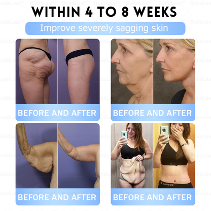 🚨 Hurry – 70% OFF Ends Soon! 🚨  Take control of your weight and health with 𝐵uil𝗱𝐿ea𝐟® GLP-1 Slim & Firm Nano Microneedle Patch. For obesity, metabolism, blood sugar and more — real results without painful injections.